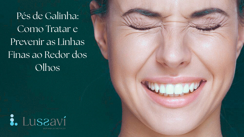 Pés de Galinha: Como Tratar e Prevenir as Linhas Finas ao Redor dos Olhos